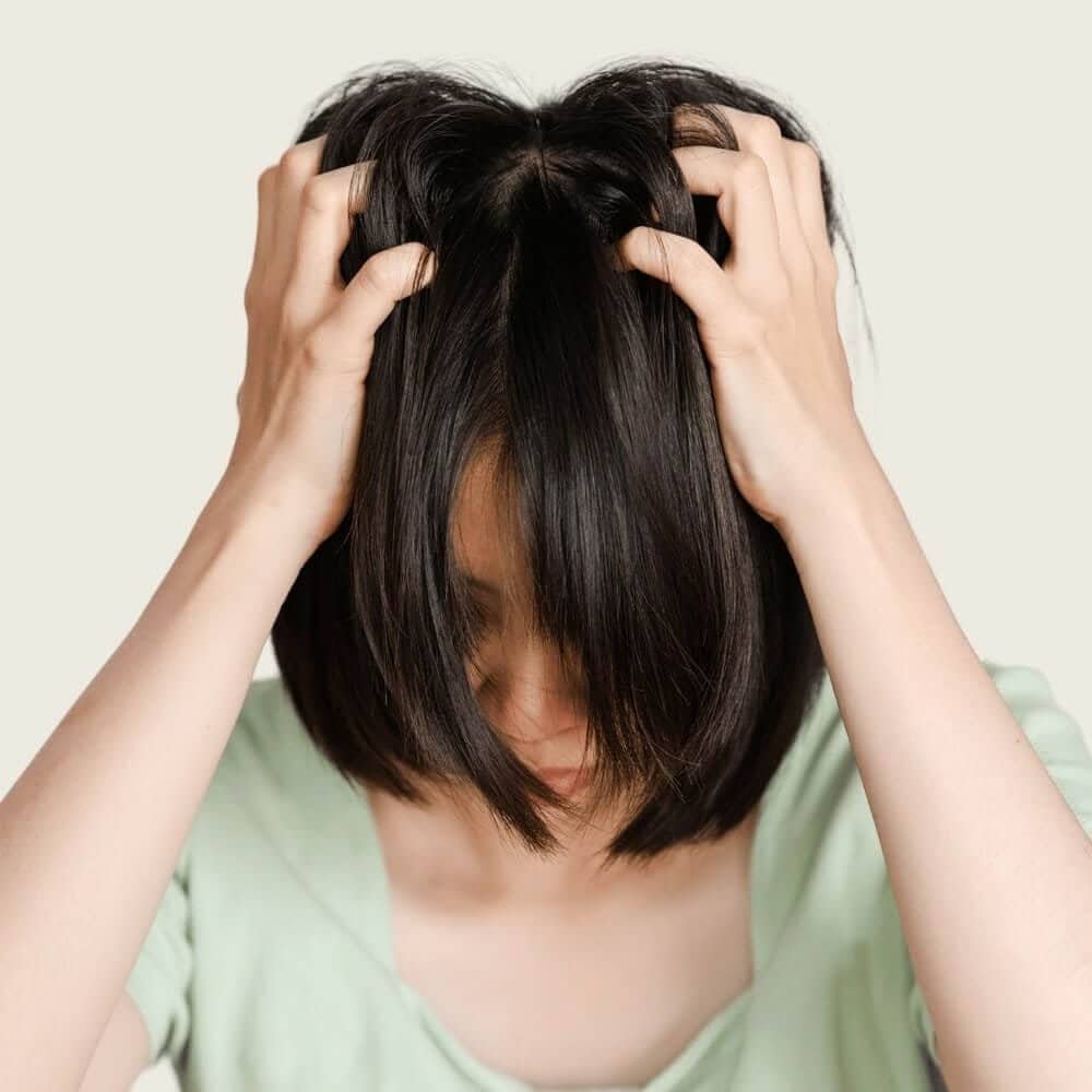 Asian woman itchy head because of dandruff or fungus on scalp. Clove Oil For Hair Growth