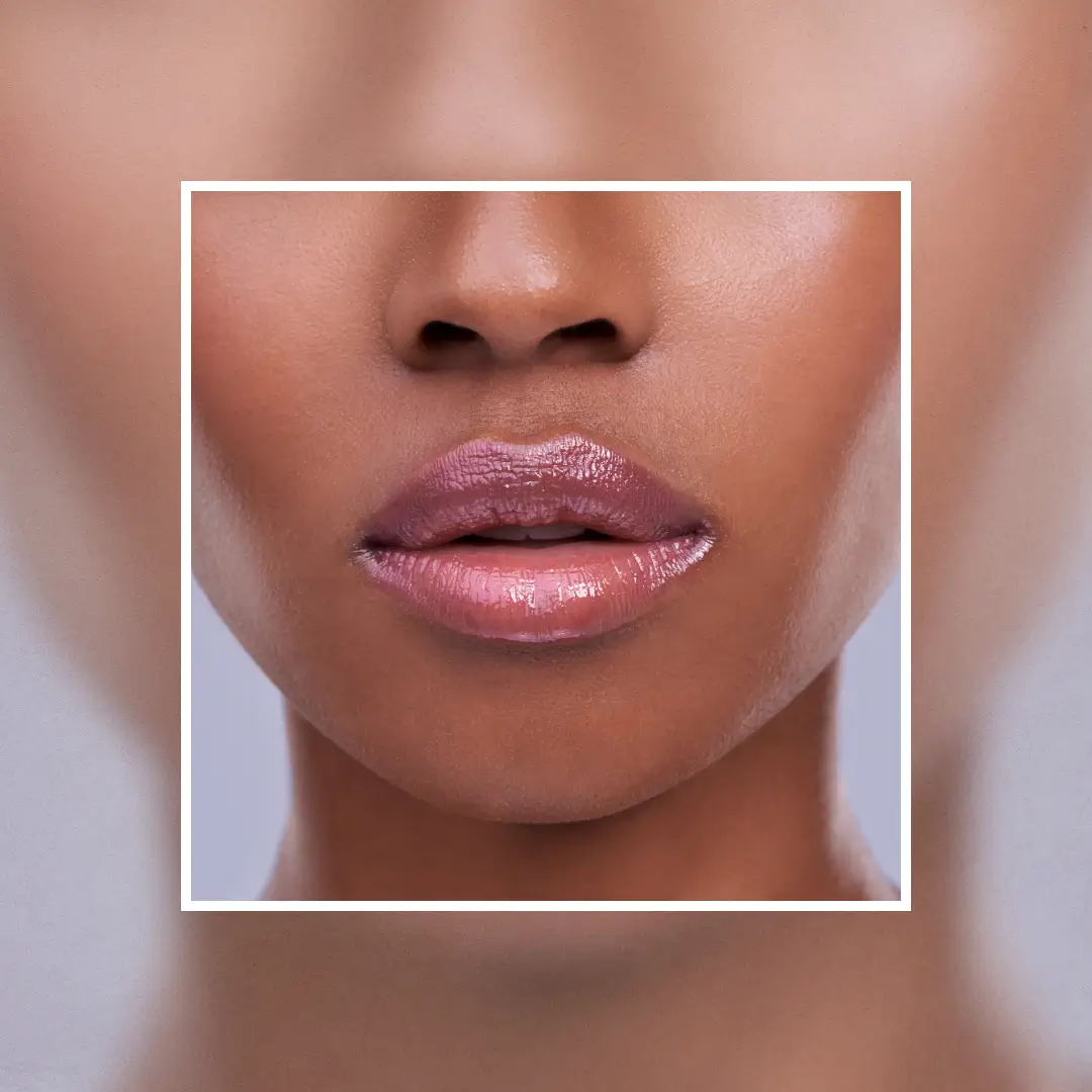 How To Get Rid Of Hyperpigmentation On The Lips