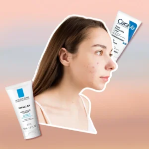 Skincare Routine for Acne-Prone Skin