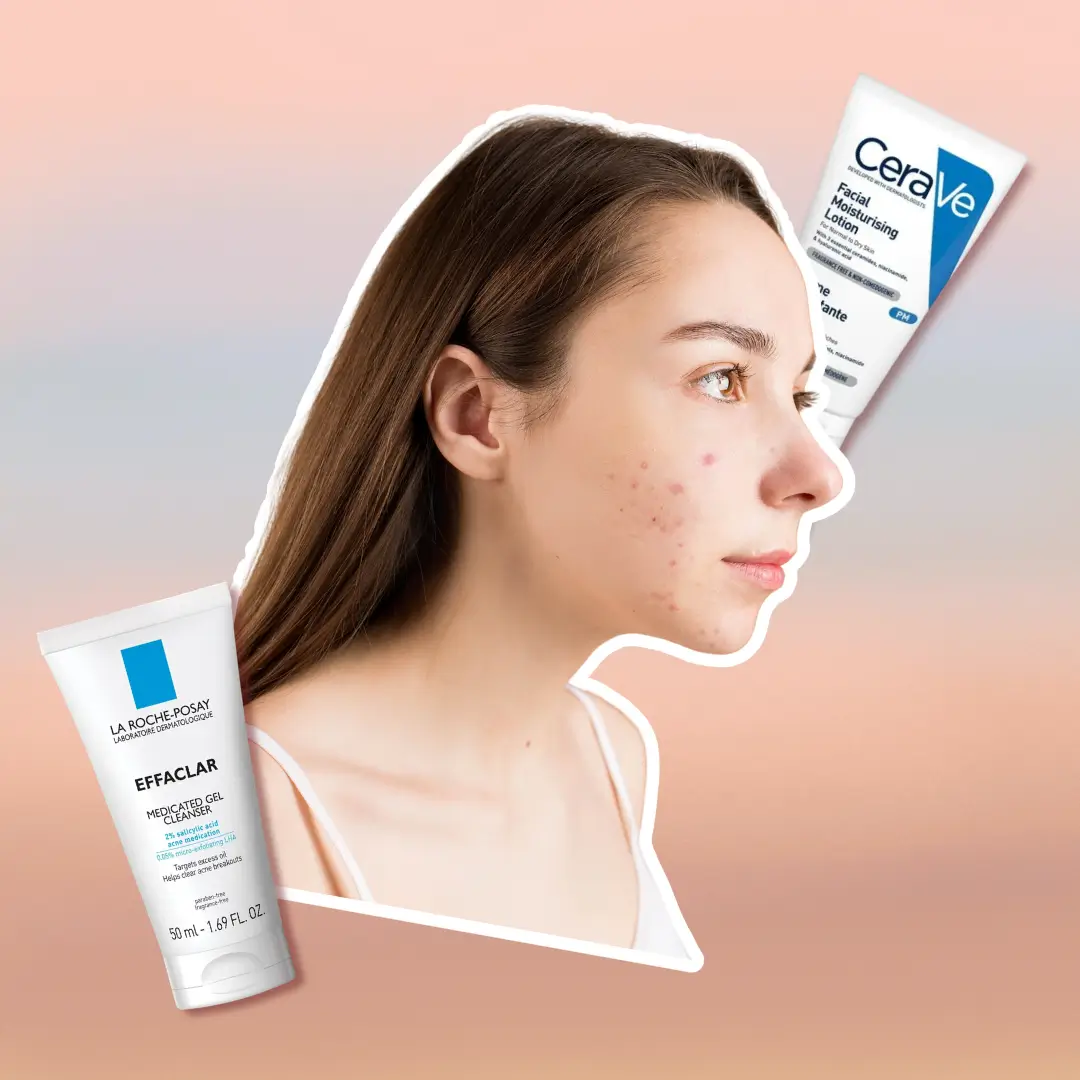 Skincare Routine for Acne-Prone Skin